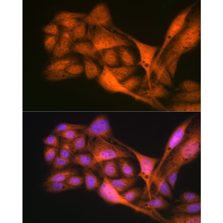 Immunofluorescence - Anti-Gli3 Antibody [ARC1941] (A308202) - Antibodies.com