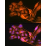 Immunofluorescence - Anti-Gli3 Antibody [ARC1941] (A308202) - Antibodies.com