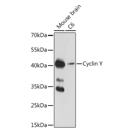 Western Blot - Anti-Cyclin Y Antibody (A308203) - Antibodies.com