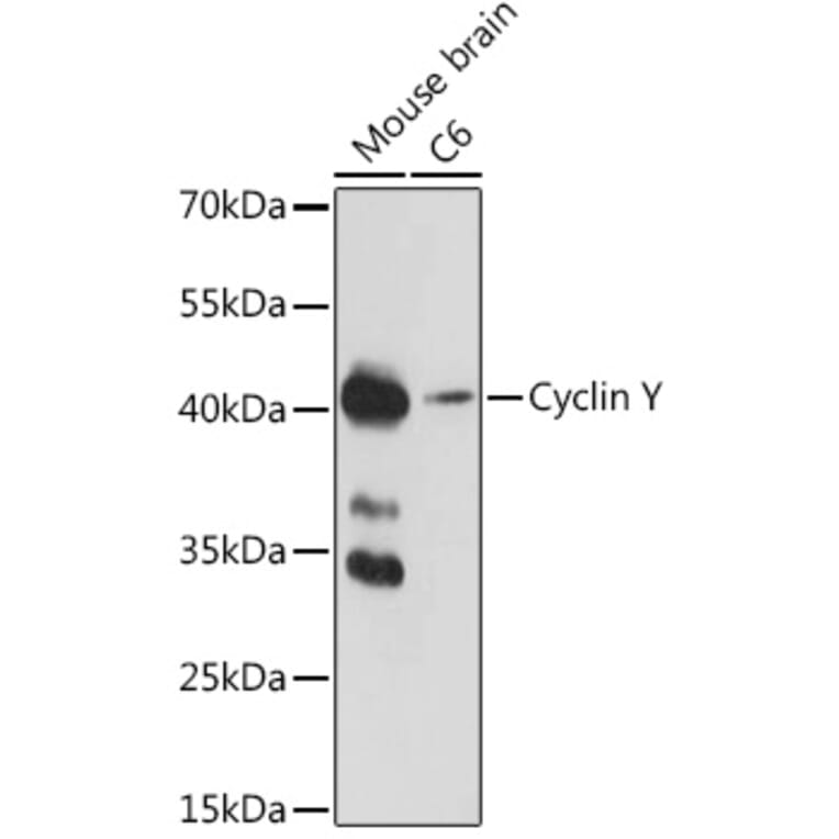 Western Blot - Anti-Cyclin Y Antibody (A308203) - Antibodies.com