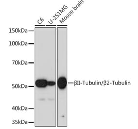 Western Blot - Anti-beta II Tubulin Antibody [ARC0227] (A308205) - Antibodies.com