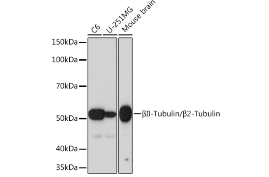 Western Blot - Anti-beta II Tubulin Antibody [ARC0227] (A308205) - Antibodies.com