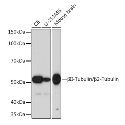 Western Blot - Anti-beta II Tubulin Antibody [ARC0227] (A308205) - Antibodies.com