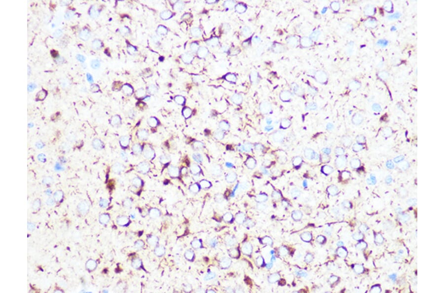 Immunohistochemistry - Anti-beta II Tubulin Antibody [ARC0227] (A308205) - Antibodies.com