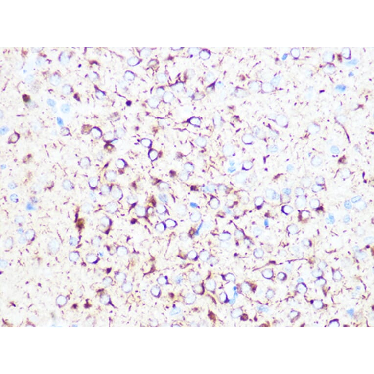 Immunohistochemistry - Anti-beta II Tubulin Antibody [ARC0227] (A308205) - Antibodies.com