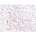 Immunohistochemistry - Anti-beta II Tubulin Antibody [ARC0227] (A308205) - Antibodies.com