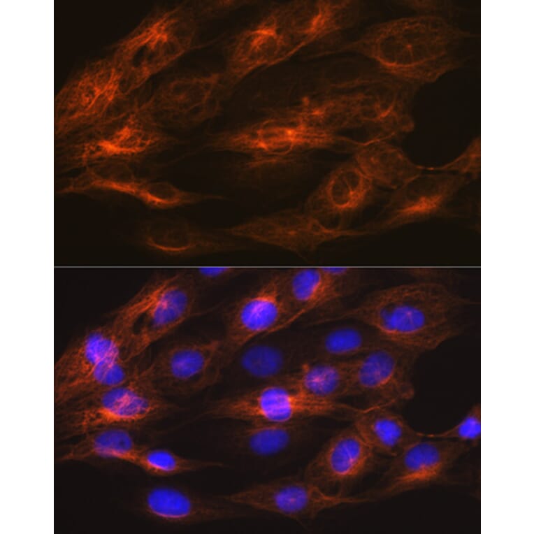 Immunofluorescence - Anti-beta II Tubulin Antibody [ARC0227] (A308205) - Antibodies.com