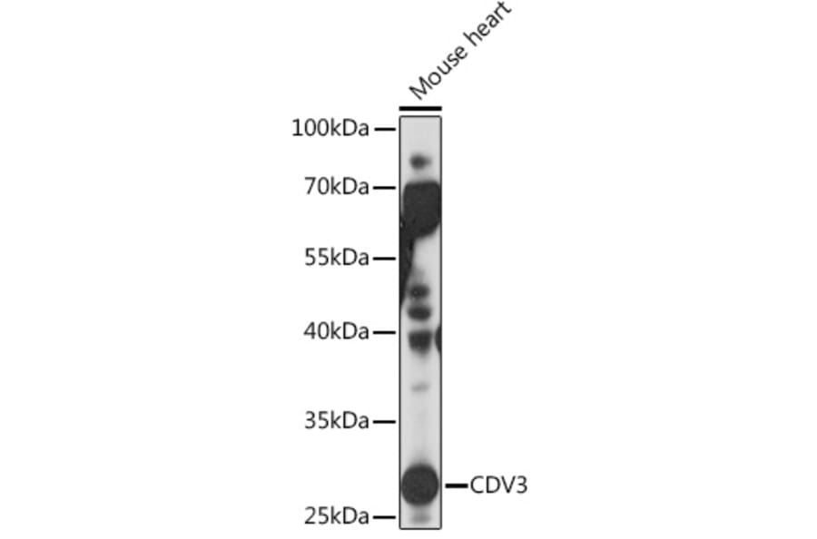 Western Blot - Anti-CDV3 Antibody (A308206) - Antibodies.com