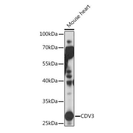 Western Blot - Anti-CDV3 Antibody (A308206) - Antibodies.com