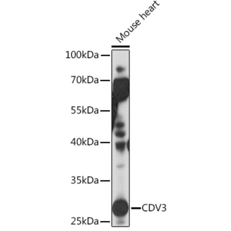 Western Blot - Anti-CDV3 Antibody (A308206) - Antibodies.com