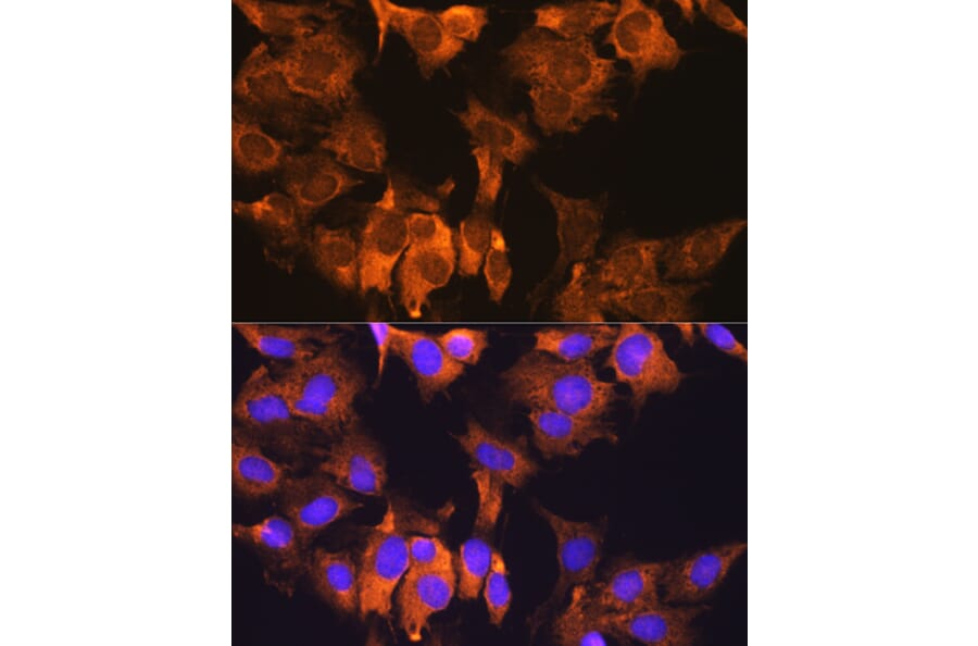 Immunofluorescence - Anti-CDV3 Antibody (A308206) - Antibodies.com