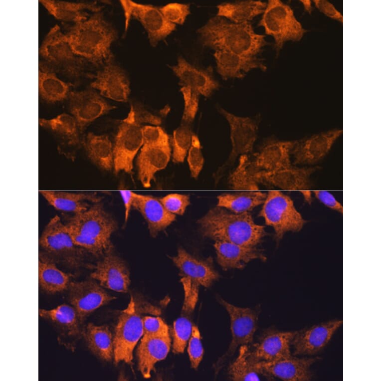 Immunofluorescence - Anti-CDV3 Antibody (A308206) - Antibodies.com