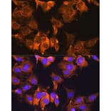 Immunofluorescence - Anti-CDV3 Antibody (A308206) - Antibodies.com