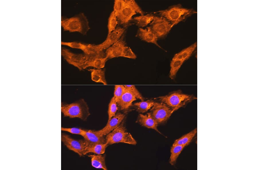 Immunofluorescence - Anti-CDV3 Antibody (A308206) - Antibodies.com