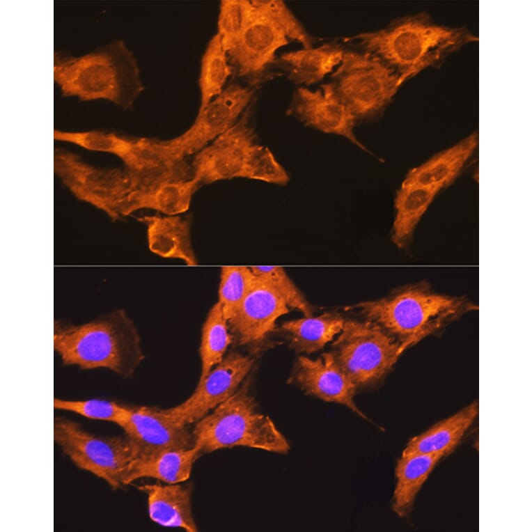 Immunofluorescence - Anti-CDV3 Antibody (A308206) - Antibodies.com