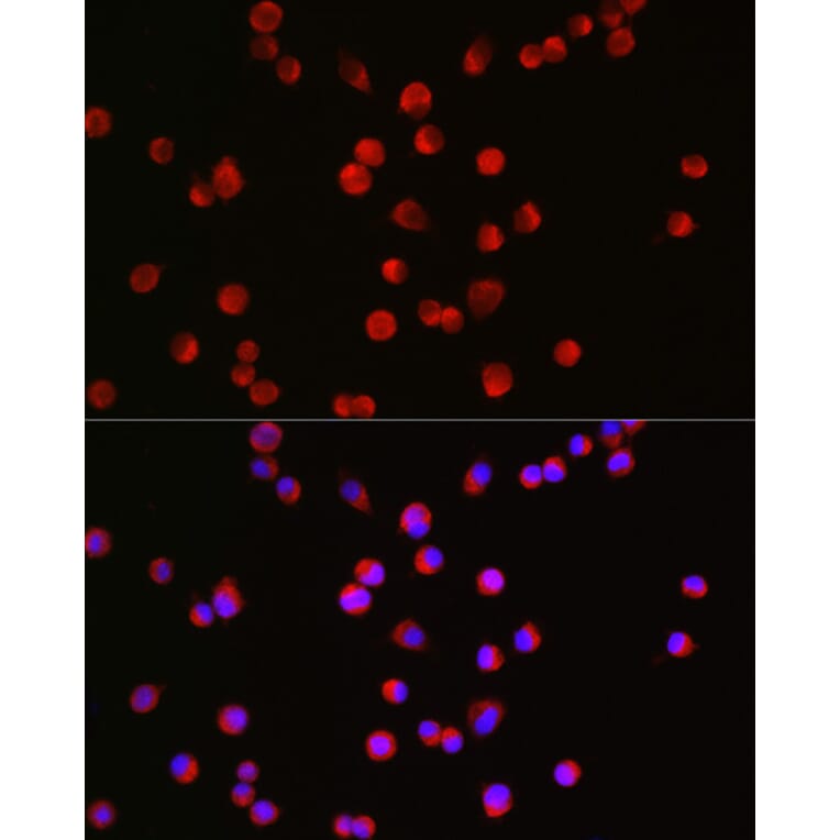 Immunofluorescence - Anti-Bassoon/BSN Antibody (A308207) - Antibodies.com