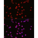 Immunofluorescence - Anti-Bassoon/BSN Antibody (A308207) - Antibodies.com