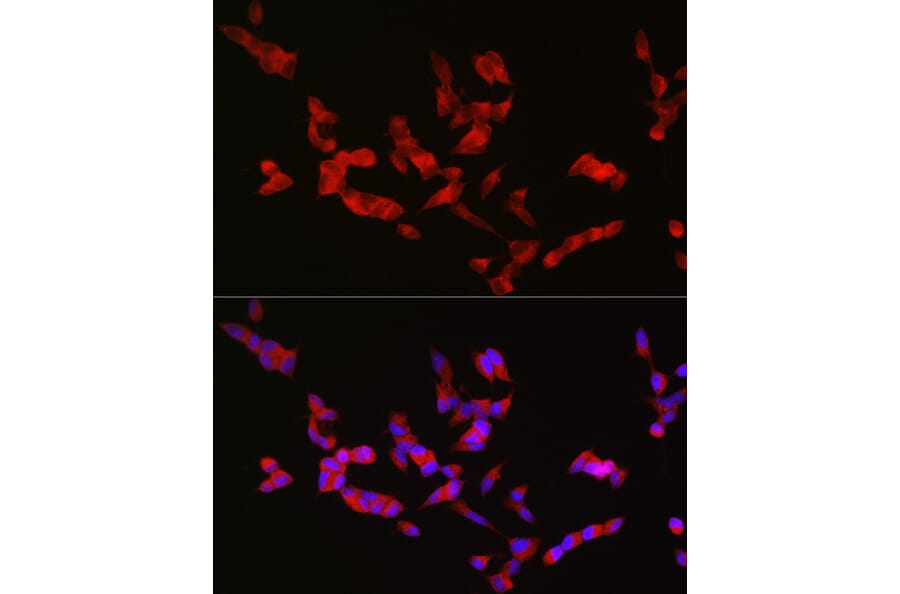 Immunofluorescence - Anti-Bassoon/BSN Antibody (A308207) - Antibodies.com