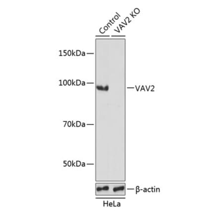 Western Blot - Anti-VAV2 Antibody (A308208) - Antibodies.com