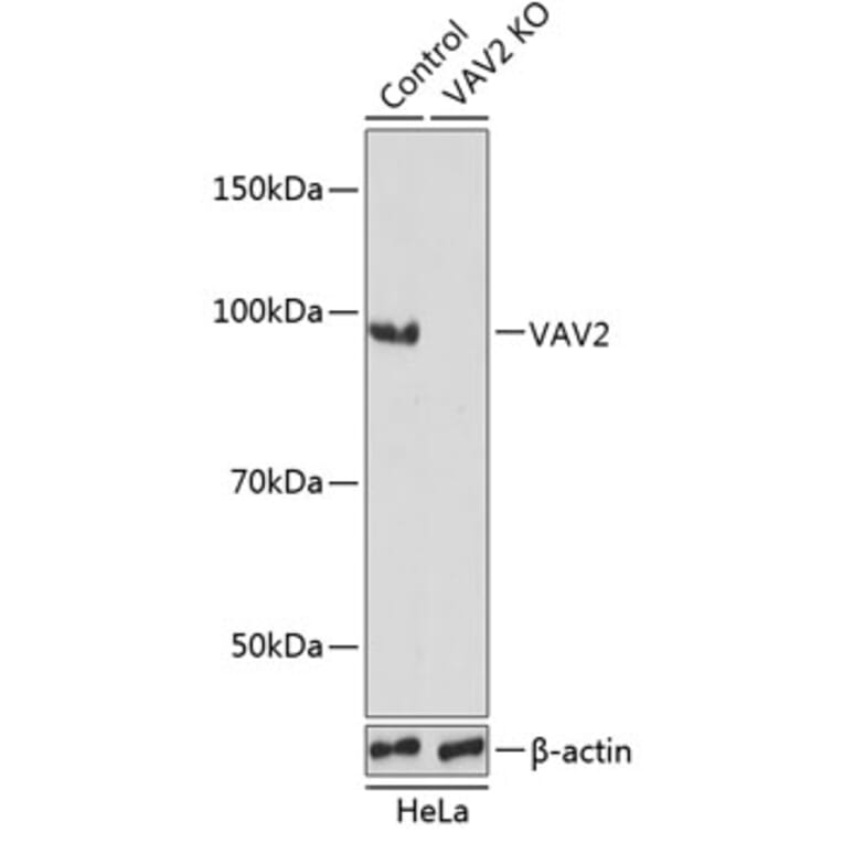 Western Blot - Anti-VAV2 Antibody (A308208) - Antibodies.com