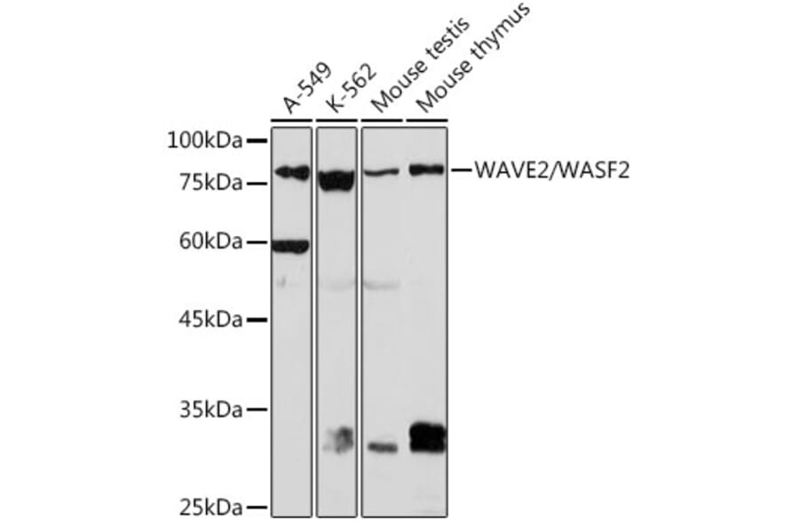 Western Blot - Anti-WASF2/WAVE2 Antibody [ARC2191] (A308210) - Antibodies.com