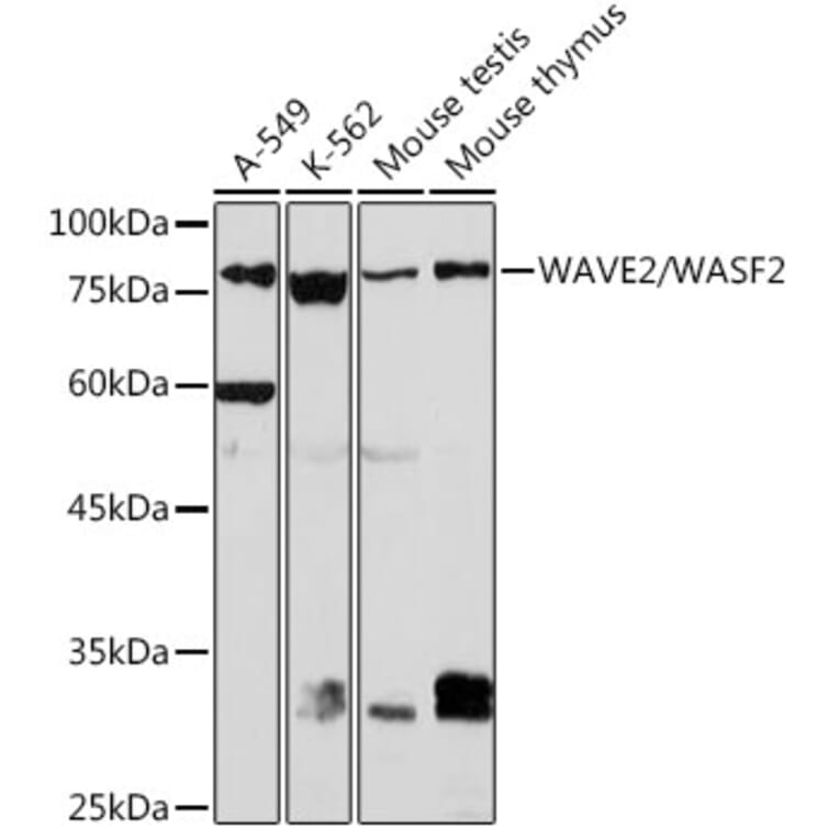 Western Blot - Anti-WASF2/WAVE2 Antibody [ARC2191] (A308210) - Antibodies.com