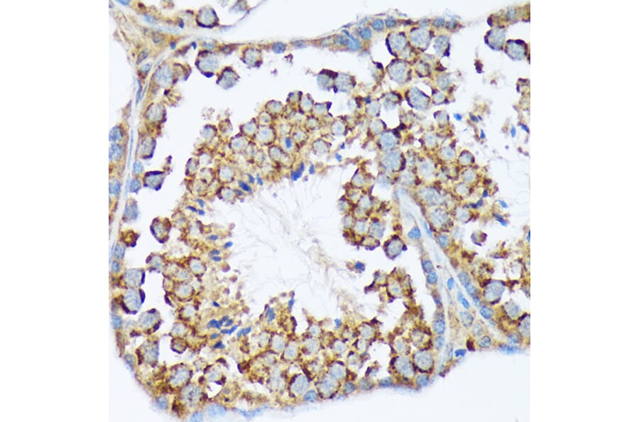 Immunohistochemistry - Anti-WASF2/WAVE2 Antibody [ARC2191] (A308210) - Antibodies.com