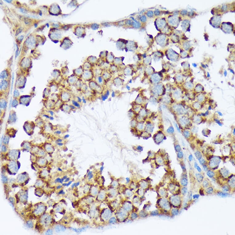 Immunohistochemistry - Anti-WASF2/WAVE2 Antibody [ARC2191] (A308210) - Antibodies.com