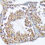Immunohistochemistry - Anti-WASF2/WAVE2 Antibody [ARC2191] (A308210) - Antibodies.com