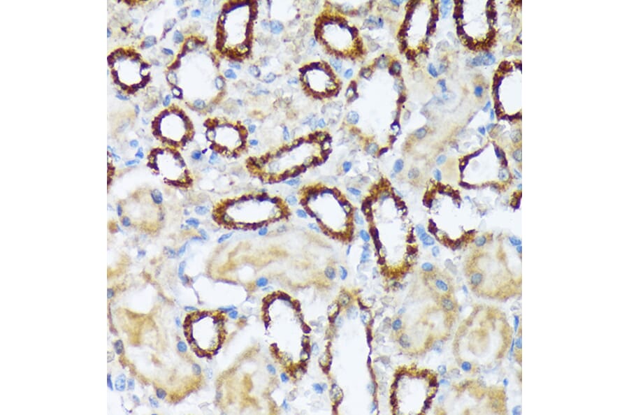 Immunohistochemistry - Anti-WASF2/WAVE2 Antibody [ARC2191] (A308210) - Antibodies.com