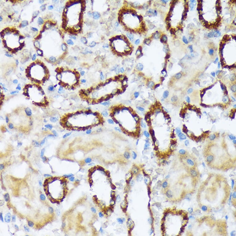 Immunohistochemistry - Anti-WASF2/WAVE2 Antibody [ARC2191] (A308210) - Antibodies.com
