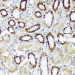 Immunohistochemistry - Anti-WASF2/WAVE2 Antibody [ARC2191] (A308210) - Antibodies.com
