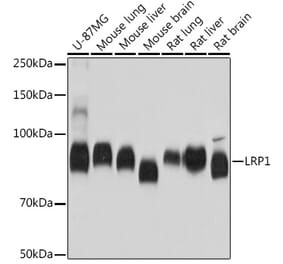 Western Blot - Anti-LRP1 Antibody [ARC0275] (A308211) - Antibodies.com