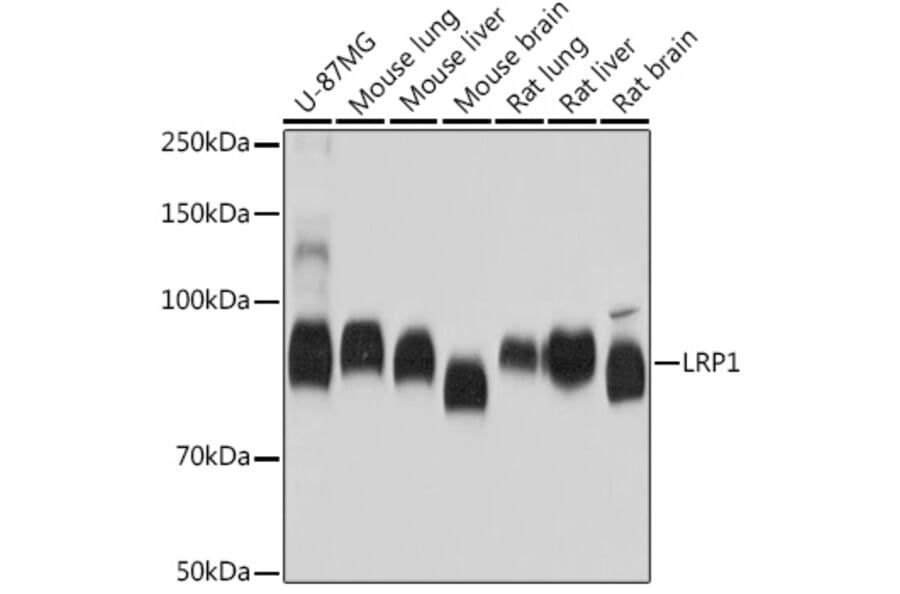 Western Blot - Anti-LRP1 Antibody [ARC0275] (A308211) - Antibodies.com