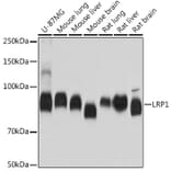 Western Blot - Anti-LRP1 Antibody [ARC0275] (A308211) - Antibodies.com