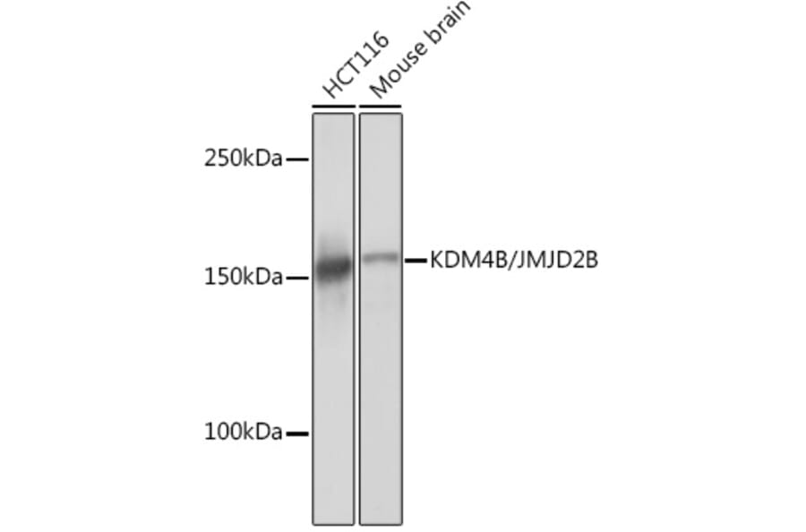 Western Blot - Anti-KDM4B/JMJD2B Antibody [ARC1416] (A308212) - Antibodies.com