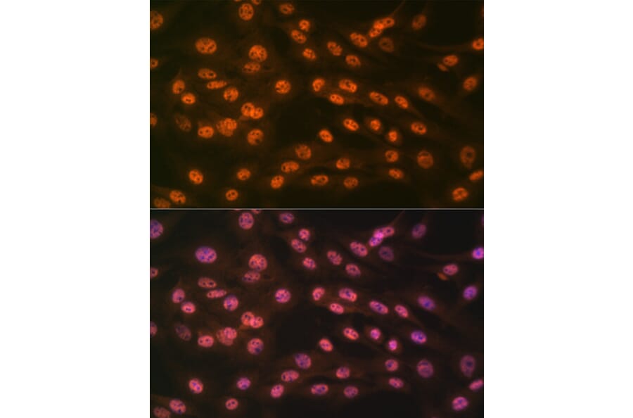 Immunofluorescence - Anti-KDM4B/JMJD2B Antibody [ARC1416] (A308212) - Antibodies.com
