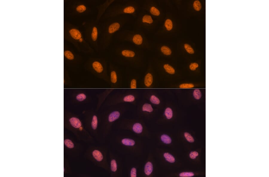 Immunofluorescence - Anti-KDM4B/JMJD2B Antibody [ARC1416] (A308212) - Antibodies.com