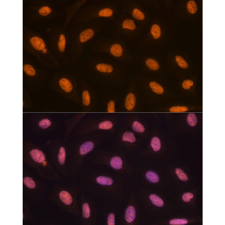 Immunofluorescence - Anti-KDM4B/JMJD2B Antibody [ARC1416] (A308212) - Antibodies.com