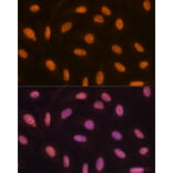 Immunofluorescence - Anti-KDM4B/JMJD2B Antibody [ARC1416] (A308212) - Antibodies.com
