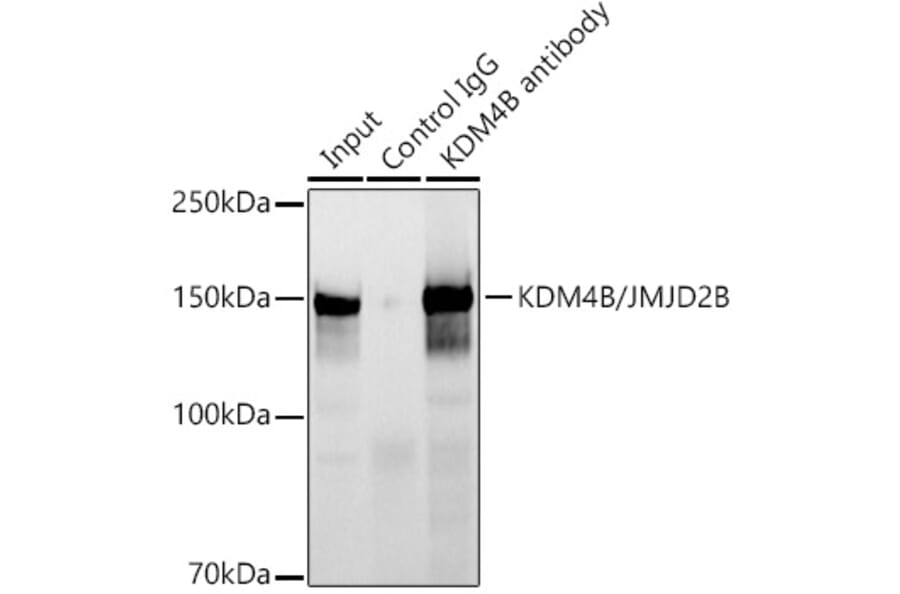 Western Blot - Anti-KDM4B/JMJD2B Antibody [ARC1416] (A308212) - Antibodies.com