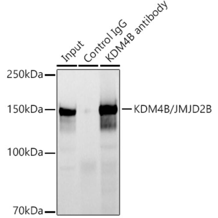 Western Blot - Anti-KDM4B/JMJD2B Antibody [ARC1416] (A308212) - Antibodies.com