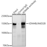 Western Blot - Anti-KDM4B/JMJD2B Antibody [ARC1416] (A308212) - Antibodies.com