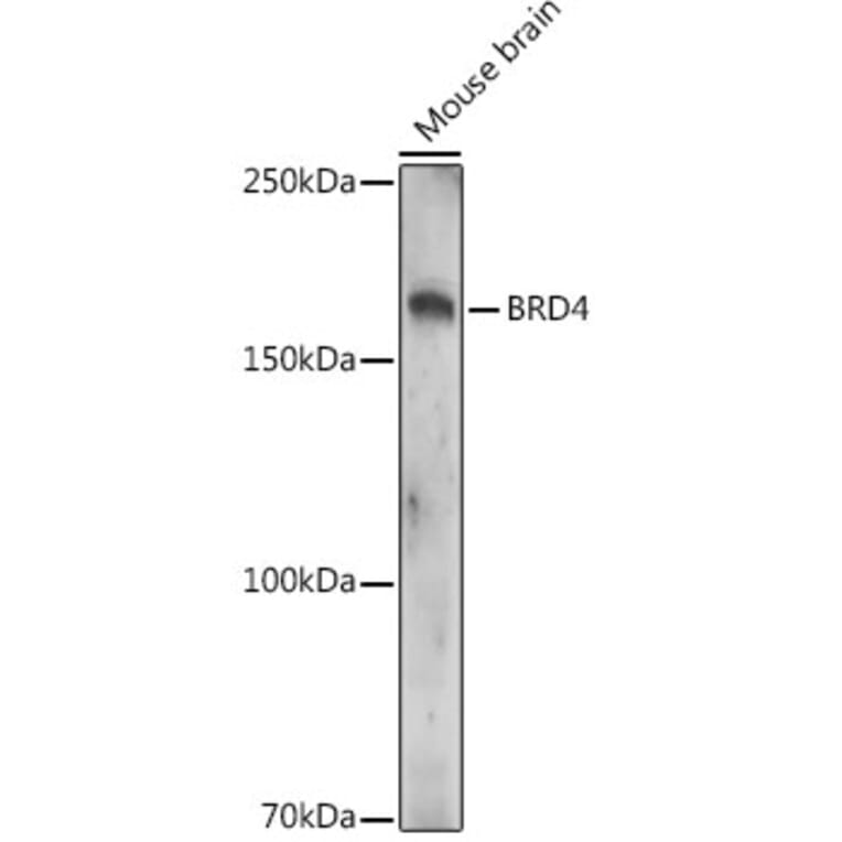 Western Blot - Anti-Brd4 (acetyl Lys332) Antibody (A308213) - Antibodies.com