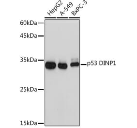 Western Blot - Anti-TP53INP1 Antibody [ARC2102] (A308214) - Antibodies.com