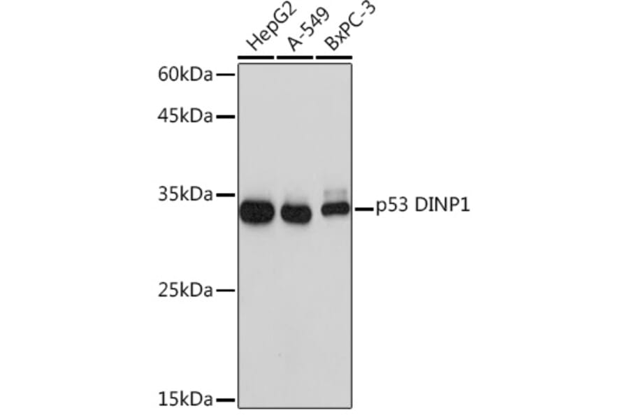 Western Blot - Anti-TP53INP1 Antibody [ARC2102] (A308214) - Antibodies.com
