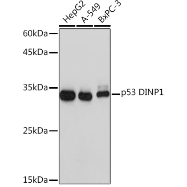 Western Blot - Anti-TP53INP1 Antibody [ARC2102] (A308214) - Antibodies.com