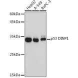 Western Blot - Anti-TP53INP1 Antibody [ARC2102] (A308214) - Antibodies.com