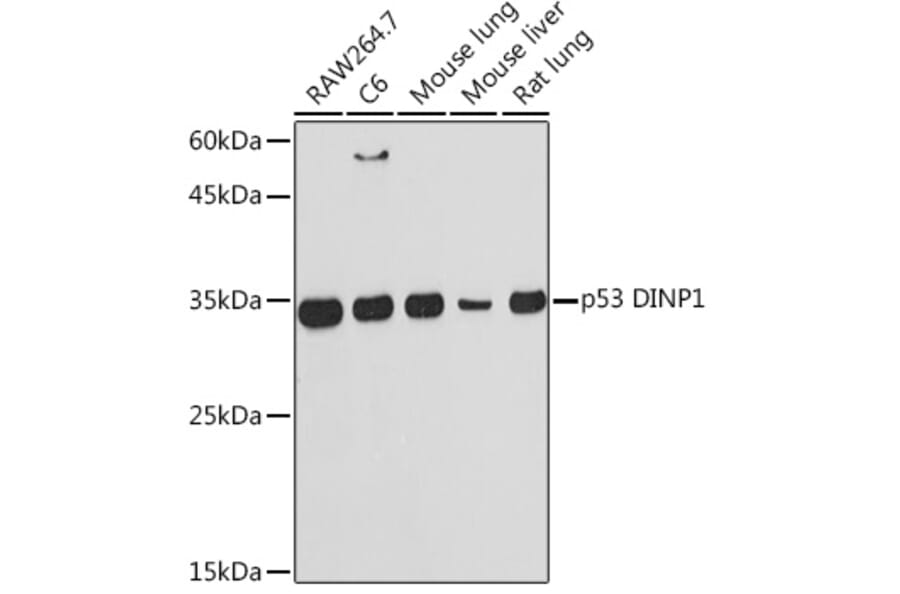 Western Blot - Anti-TP53INP1 Antibody [ARC2102] (A308214) - Antibodies.com