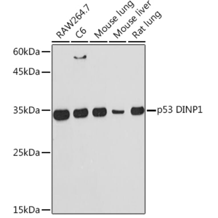 Western Blot - Anti-TP53INP1 Antibody [ARC2102] (A308214) - Antibodies.com